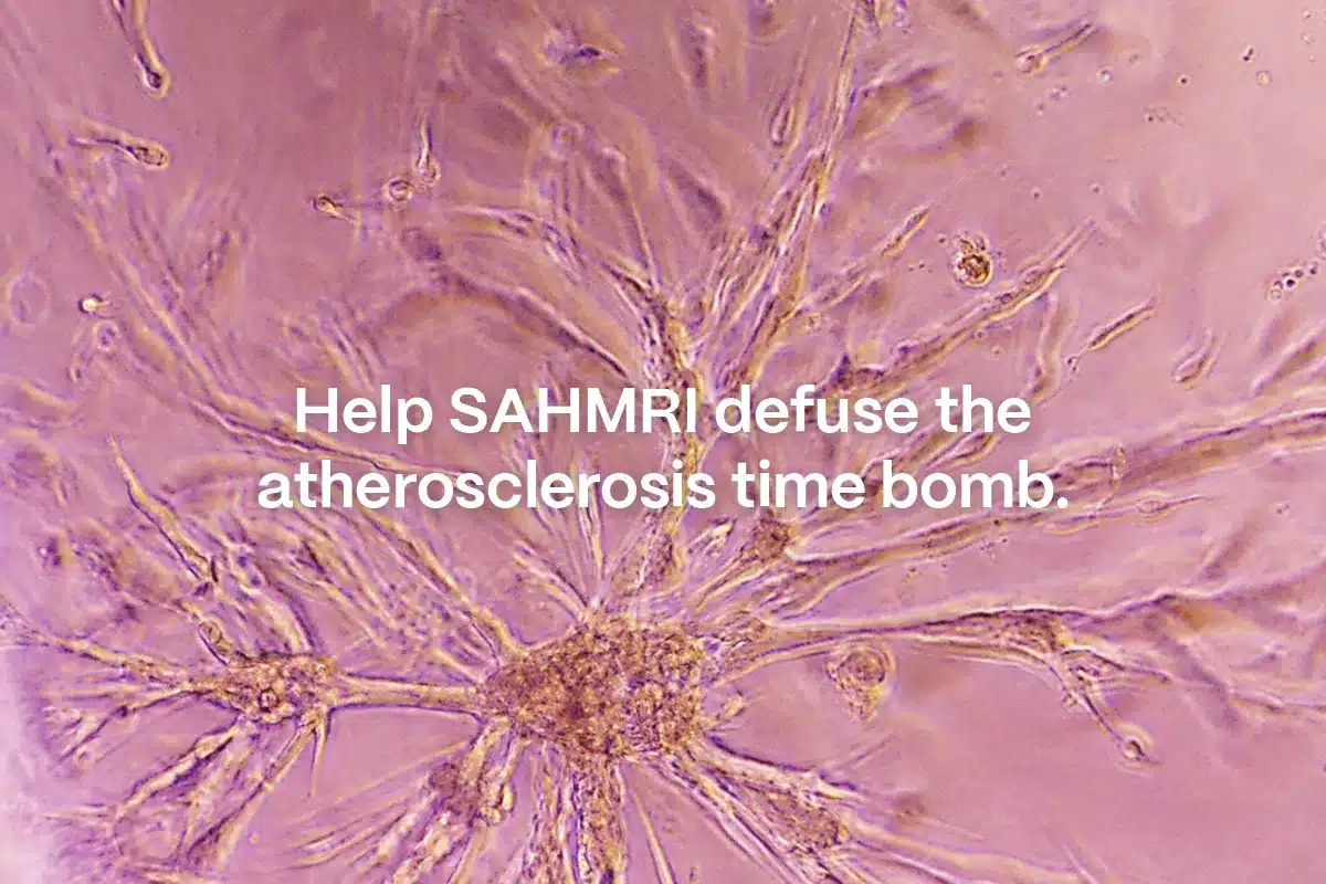 Microscope image of a star-shaped cell cluster with the text "Help SAHMRI defuse the atherosclerosis time bomb"